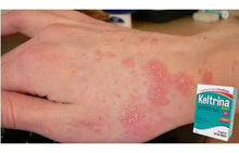 Carregar imagem no visualizador da galeria, KELTRINA PLUS 5% 10MG/ML LOÇÃO 60 ML (PERMETRINA) MULTILAB