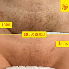 Carregar imagem no visualizador da galeria, SÉRUM CLAREADOR CORPORAL FOLIPRO 130G
