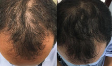 Carregar imagem no visualizador da galeria, KIT SHAMPOO+TÔNICO BIOXIDIL JARON
